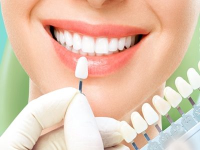 antalya-zirkonyum-kaplama