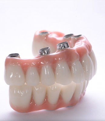 implant-ustu-sabit-protezler-1575297166.91396-2