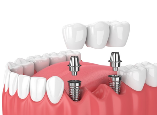 shutterstock_1050054875-1